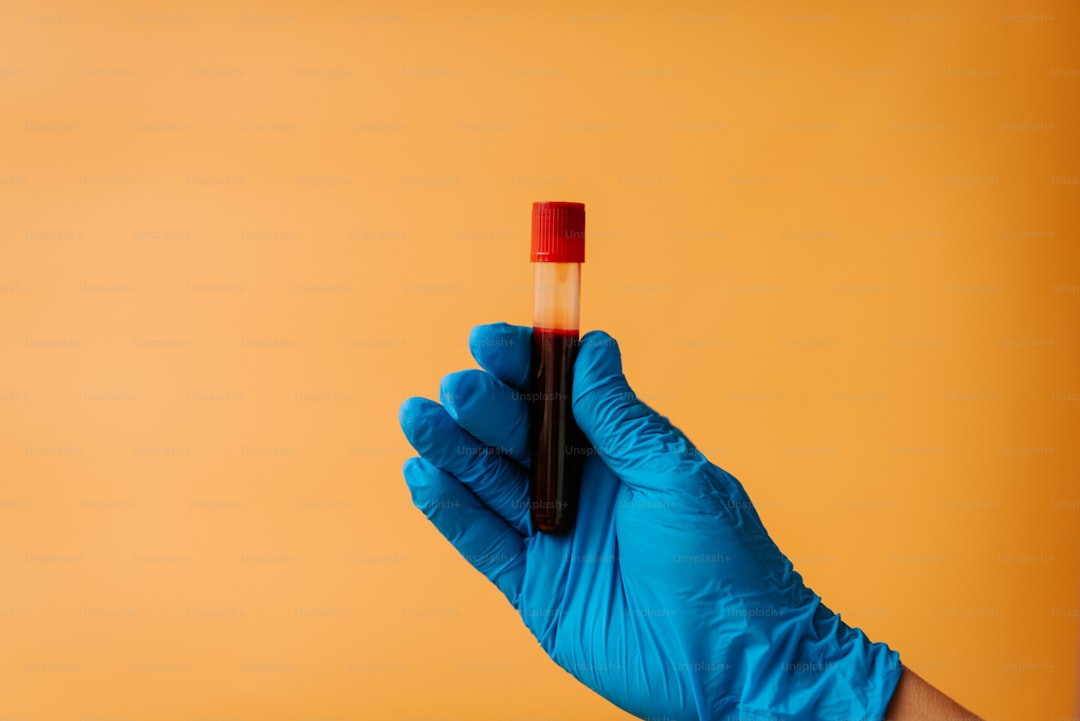 Ege'de Yüksek Polifenol İçeren Zeytinyağının Yaratıcılığı - polyphenol test